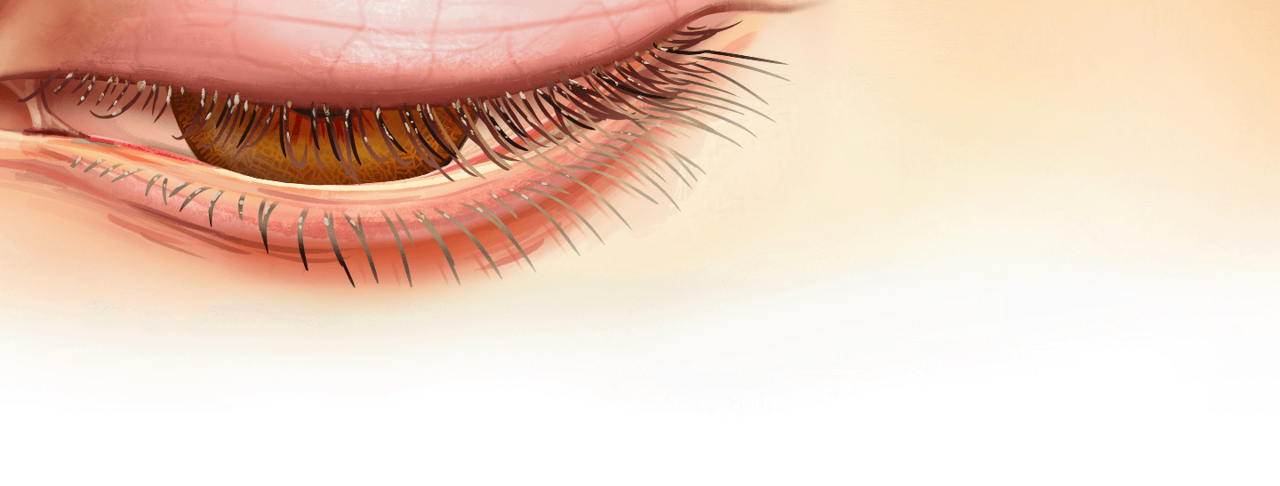 animation of illustrated demodex mites holding party favors in front of an illustrated eye