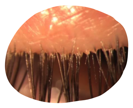 eye-light