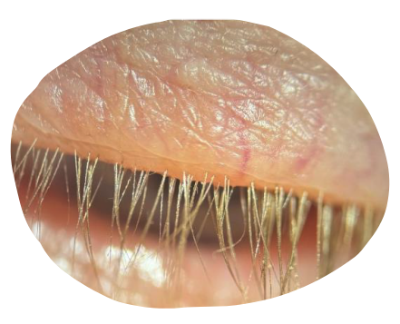 eye-light