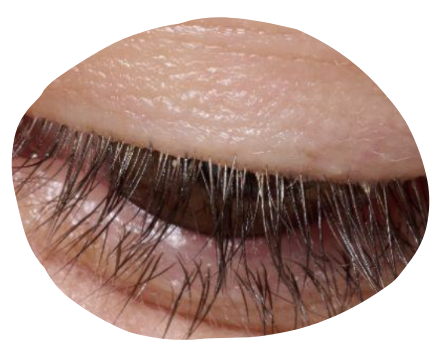 eye-light