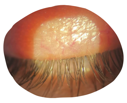 eye-light