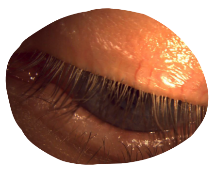 eye-light