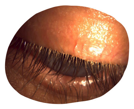 eye-light