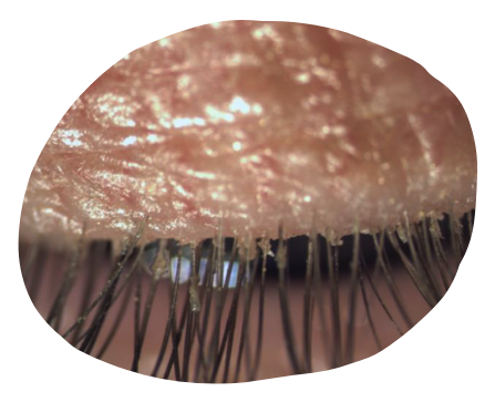 eye-light