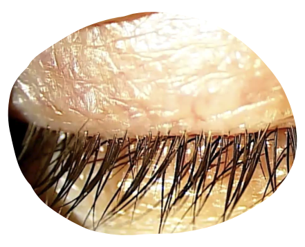 eye-light